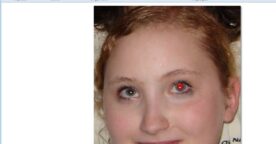 Trois services pour supprimer les yeux rouges sur les photos